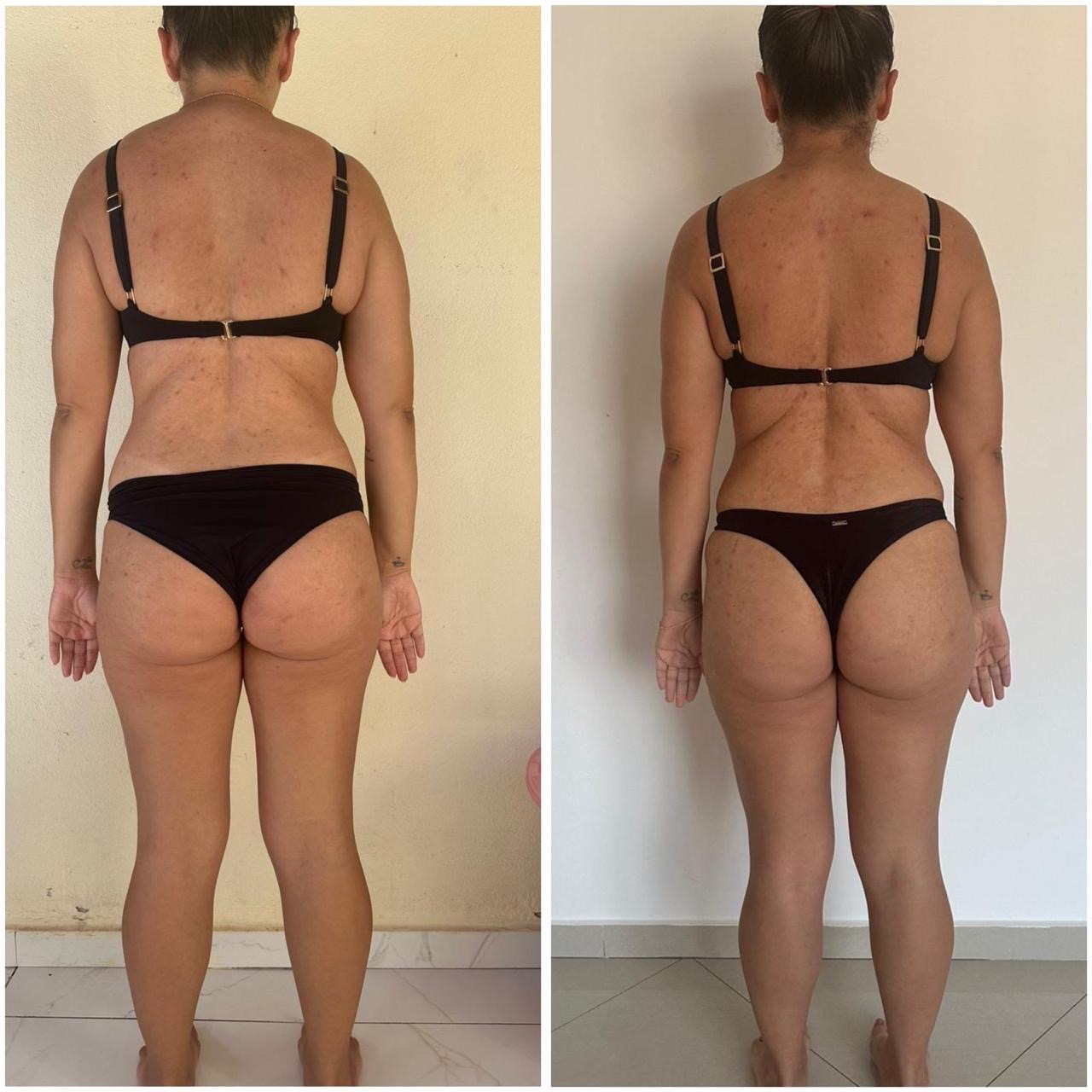 Aluna do Combustível Diário de costas, de biquíni preto: à esquerda o registro anterior, à direita o atual, com menos volume no flanco e na parte alta da coxa.